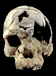 ethiopian.160kold.skull.jpg